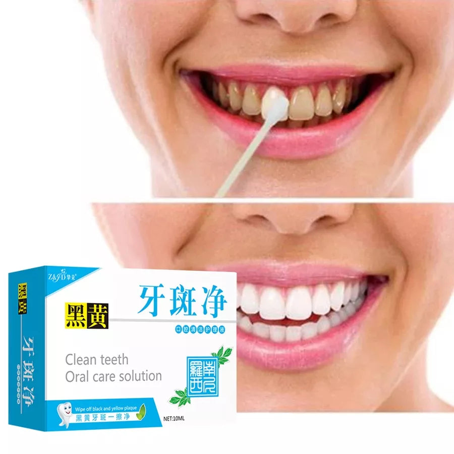 Dentes Essência De Oral Limpeza Remover Manchas De Fresco Ferramentas Dental