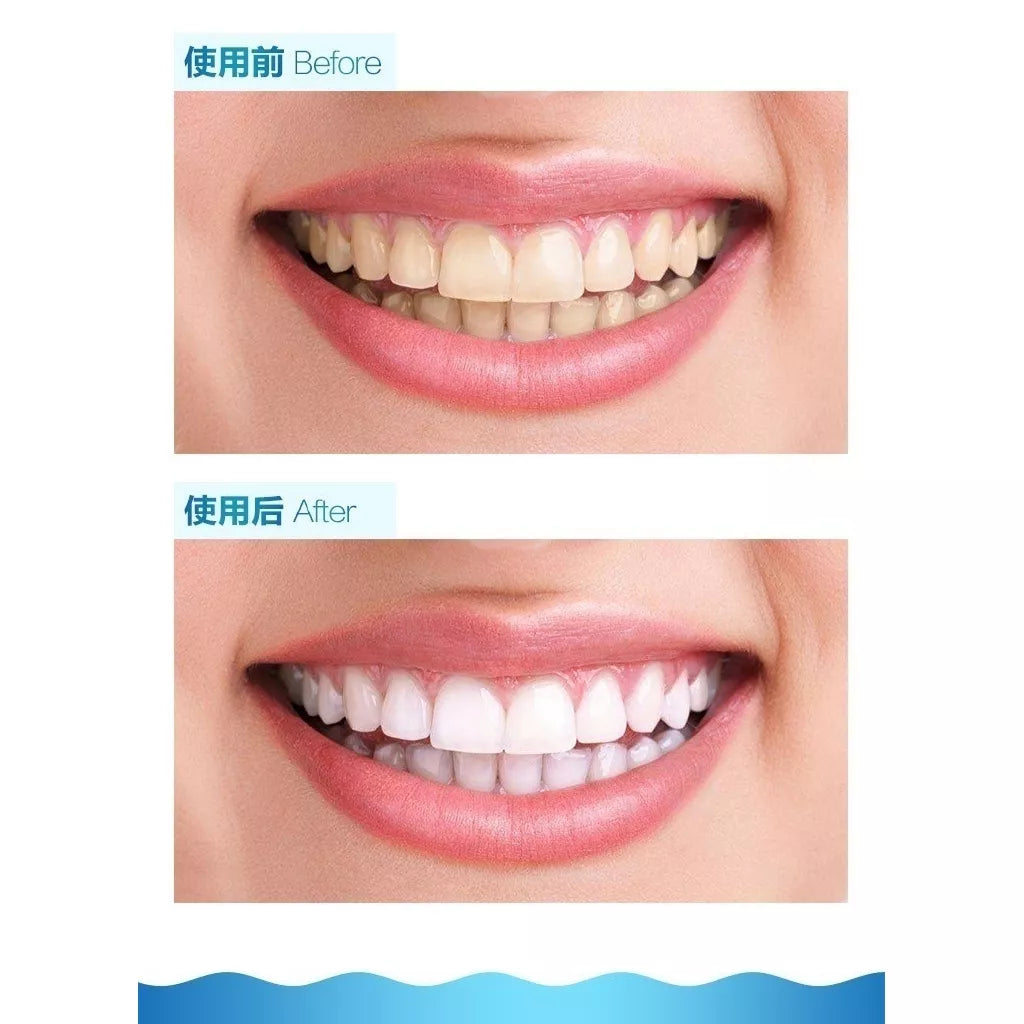 Mini Aparelho De Limpeza De Dentes / Branqueadora / Oral Blu-Ray
