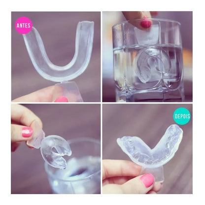 2 Pares (4 unidades) Moldeira Molde Clareamento Dental Clareador